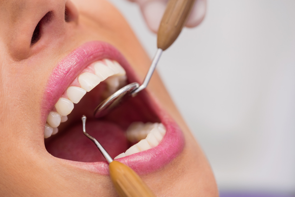 Close-up of a dental examination